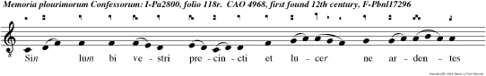 Sin lum bi vestri precincti et lucer ne ardentes in manibus vestris et vos similes hominibus expectantibus dominum suum quan do  revertatur a nuptiis.